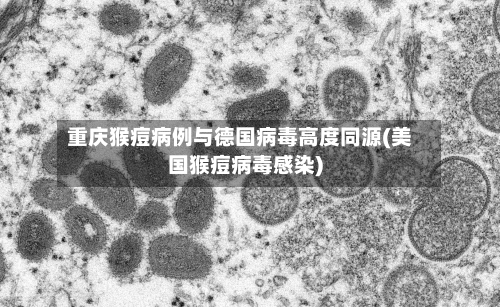 重庆猴痘病例与德国病毒高度同源(美国猴痘病毒感染)