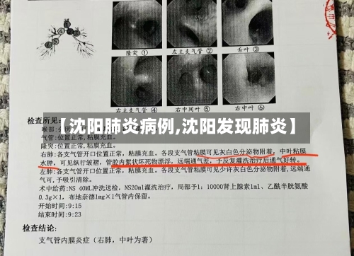 【沈阳肺炎病例,沈阳发现肺炎】